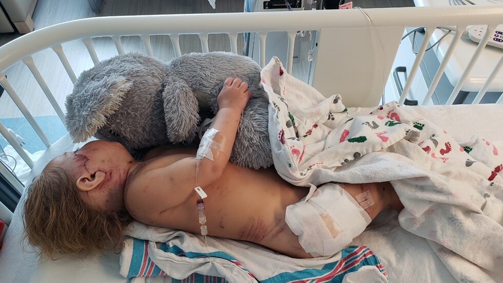 Lynn Boyd's 18-month-old son is currently recovering from injuries he received after being...